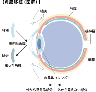 アイバンク 当院について 大阪市東成区にある眼科専門病院 西眼科病院